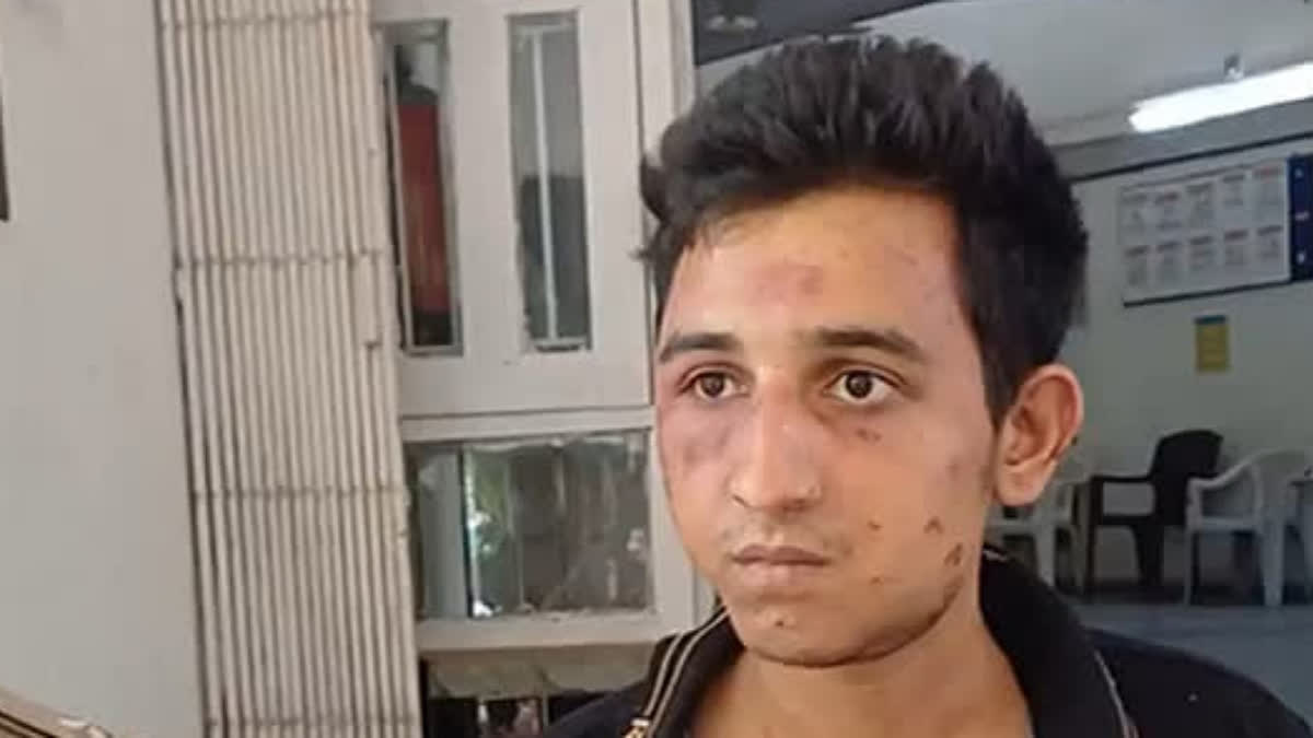 'Was Not Drunk', Says Vadodara Accident Accused After A Woman Dies In Collision With His Car Vadodara Accident Accused Rakshit Ravish Chaurasia