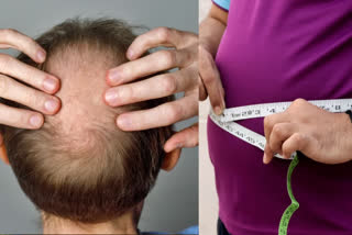 WEIGHT LOSS MEDICINES FOR HAIR