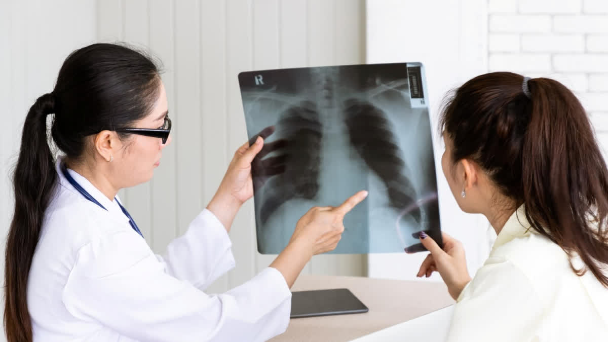 Doctor shows a chest X-ray to a patient