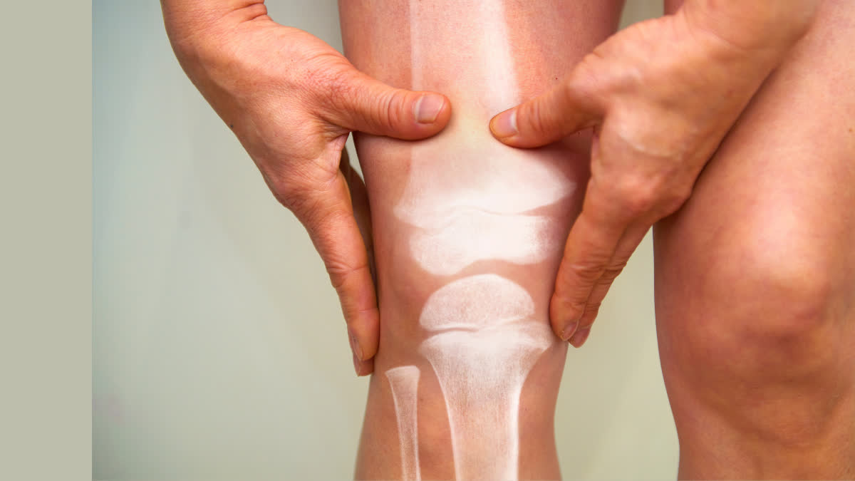 गठिया की समस्या