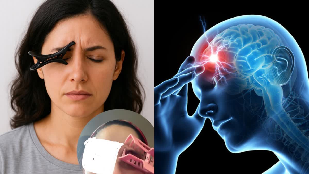 Viral Social Media Migraine Hacks