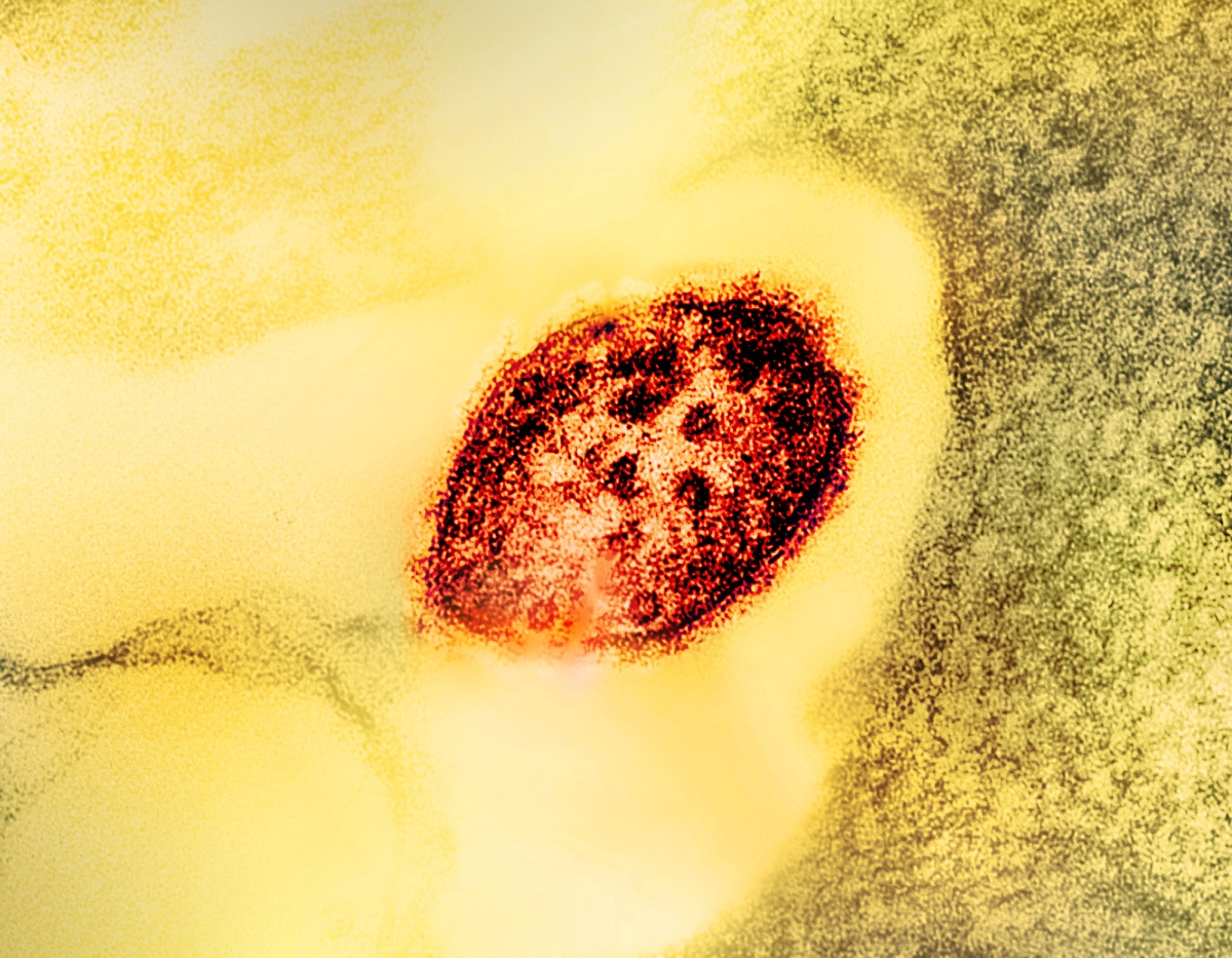 Colorized transmission electron micrograph of a measles virus particle