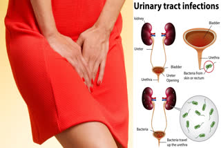 UTI PROBLEMS DURING MONSOON  WAYS TO PREVENT UTI PROBLEMS  UTI PROBLEMS  ಮಳೆಗಾಲದಲ್ಲಿ ಯುಟಿಐ ಪ್ರಕರಣಗಳು ಹೆಚ್ಚಳ