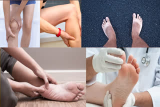 Signs of serious illness and vitamin deficiencies are first seen in the feet, do not ignore them.