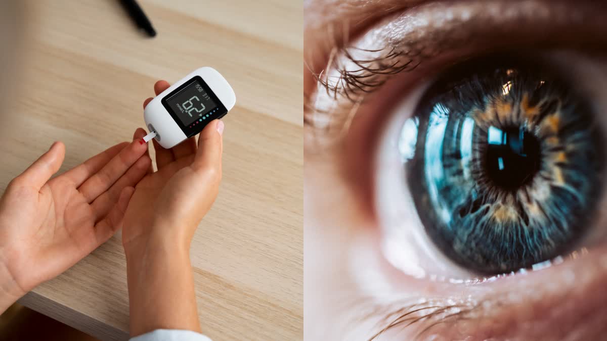 DIABETIC RETINOPATHY