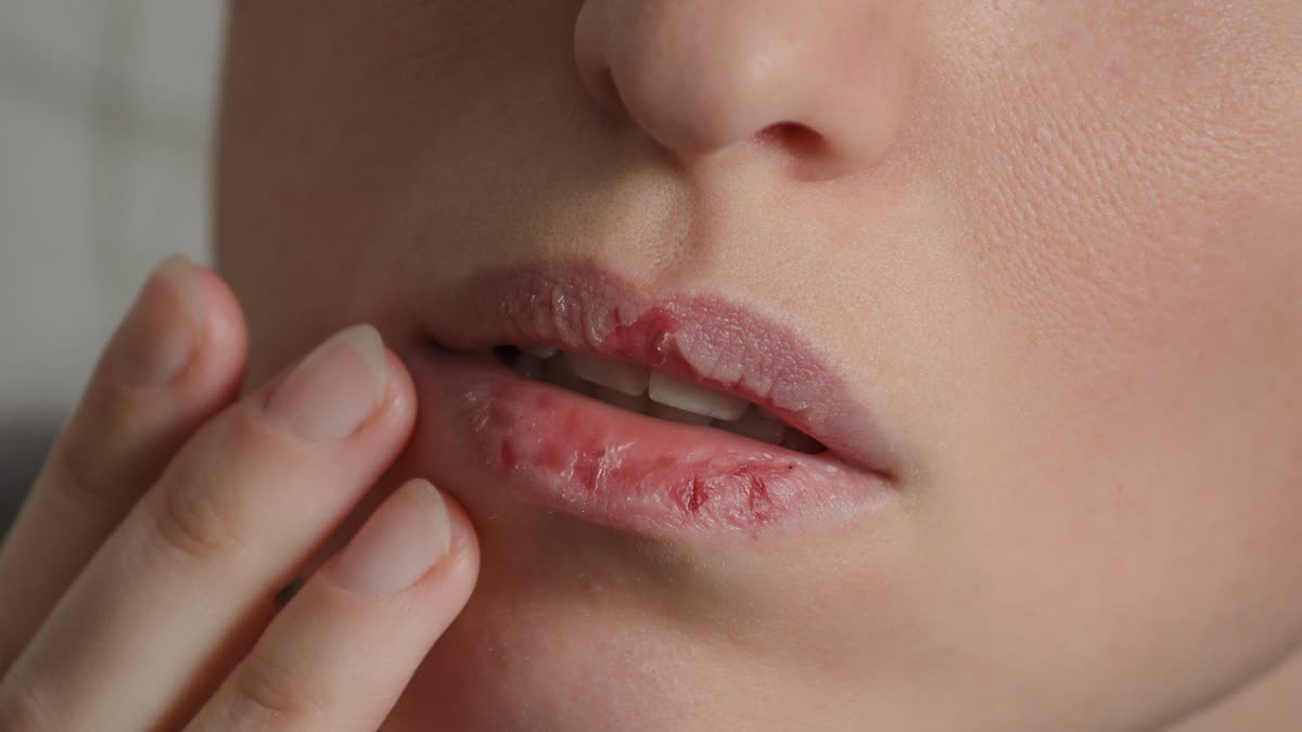 உதடு வெடிப்பா? பட்டு போன்ற உதடு வேண்டுமா? சூப்பரான டிப்ஸ் இதோ!