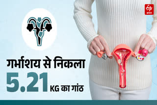 5 KG FIBROID SURGERY IN MANDI