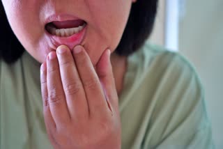 ORAL CANCER CAUSES