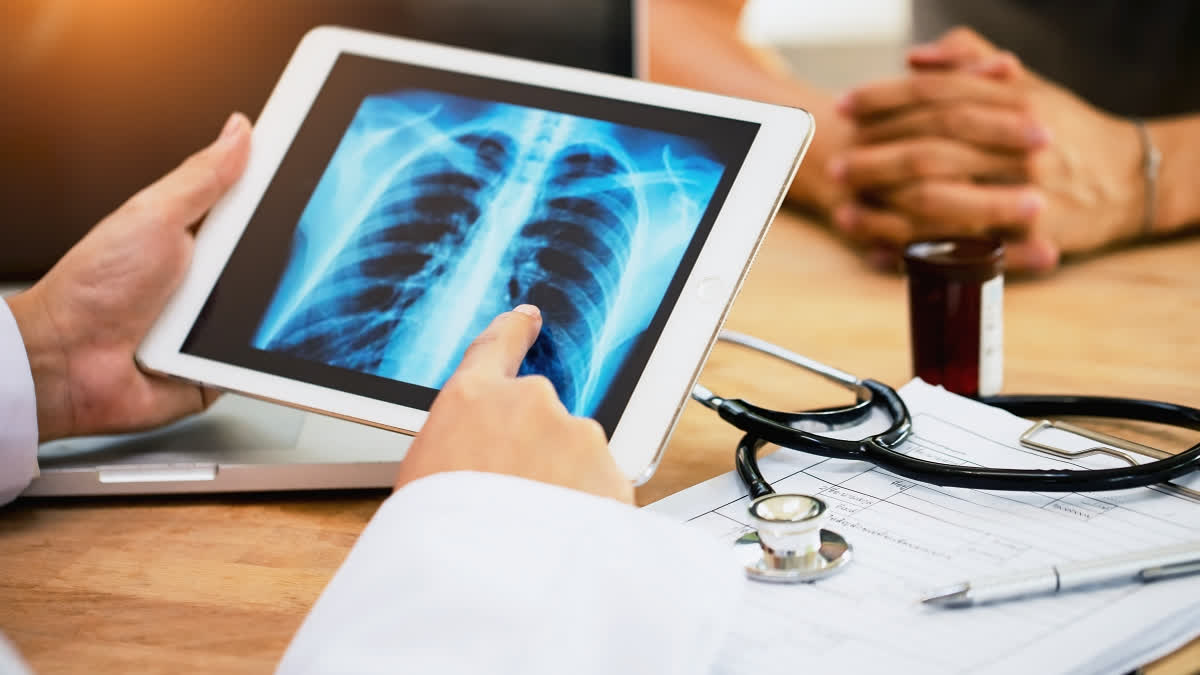 New Nasal Drug Delivery Method Can Reduce TB Bacteria In Brain By 1,000x Scientists have developed a unique way through the nose to deliver tuberculosis (TB) medicines directly to the brain.