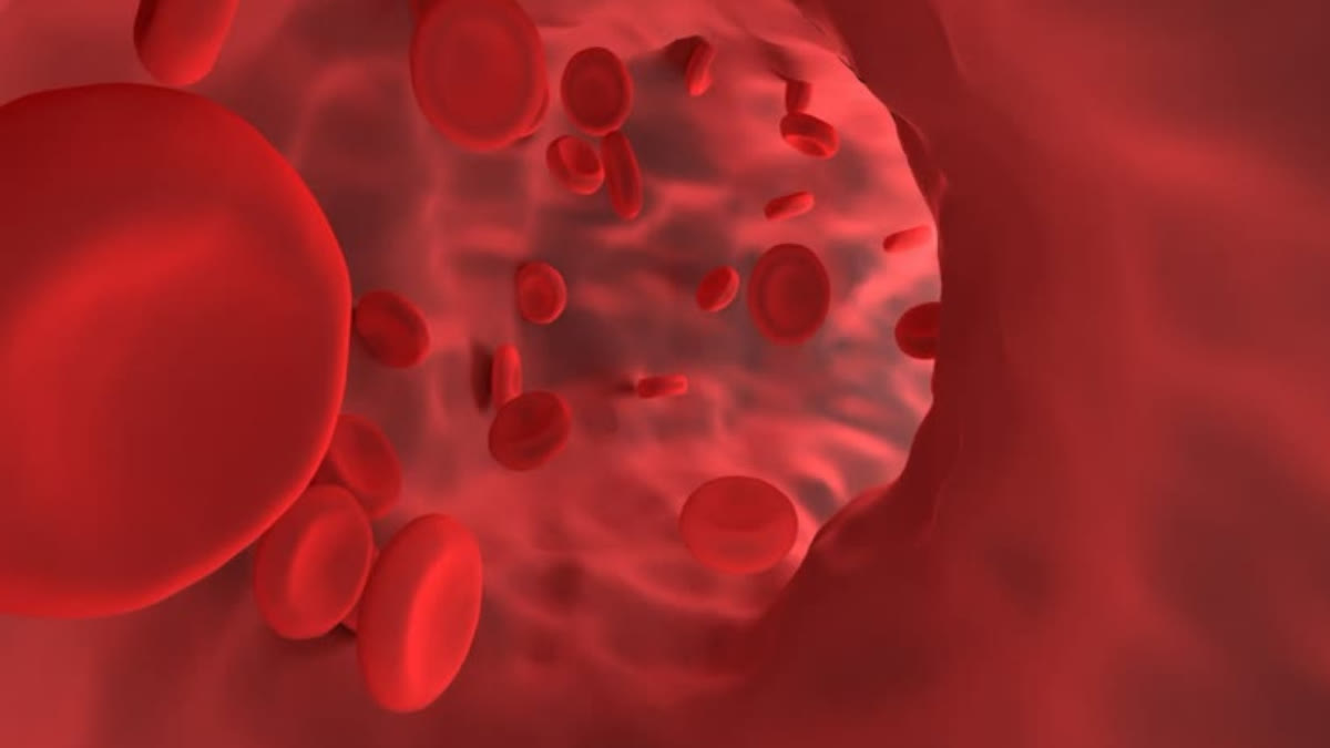 Learn about the symptoms and signs that indicate you may have iron deficiency or anemia.