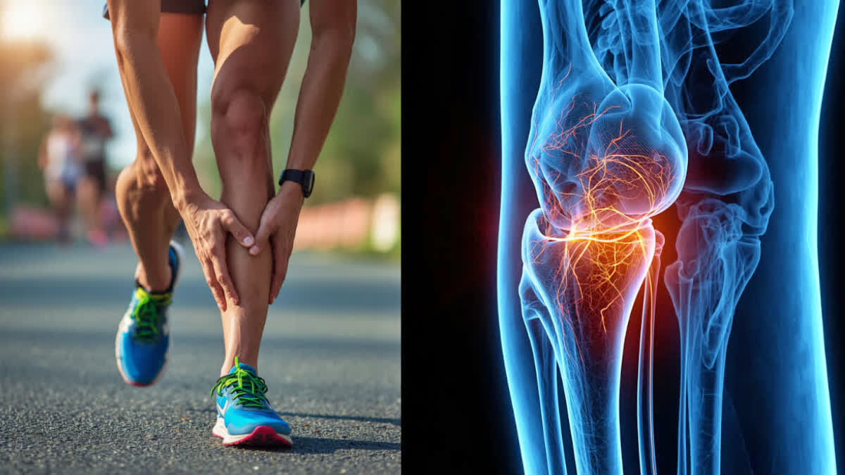 Does walking or running cause leg pain?