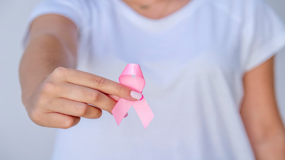 Colon Cancer