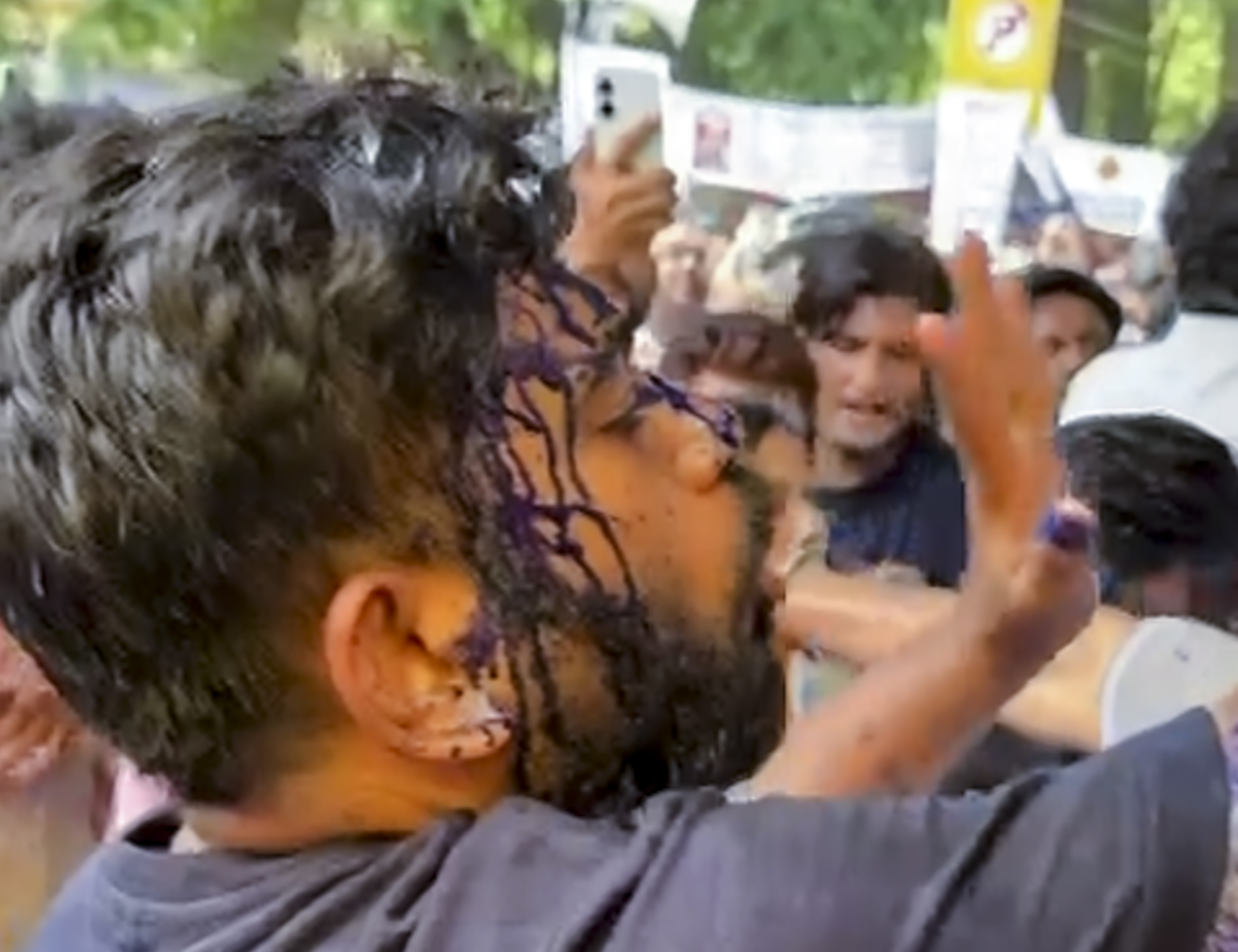 Cockroach Janata Party (CJP) founder Abhijeet Dipke reacts after a woman threw an ink-like liquid on him at Jantar Mantar, in New Delhi.