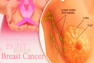 ROUTINE AFTER BREAST CANCER