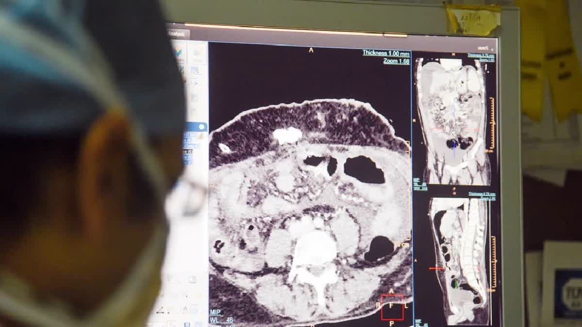 New Study Overturns Five-Decade-Old Model of Bacterial Gene Regulation