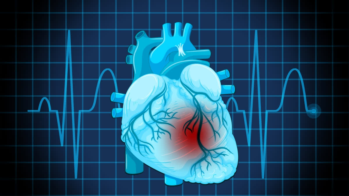 Diseased heart