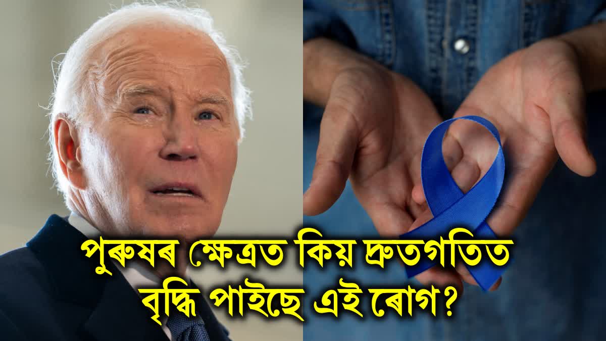 AGGRESSIVE PROSTATE CANCER