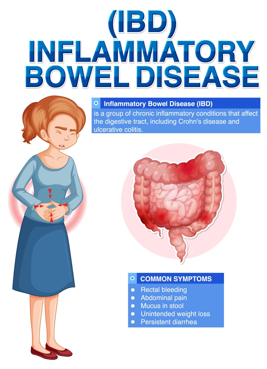 Infographic