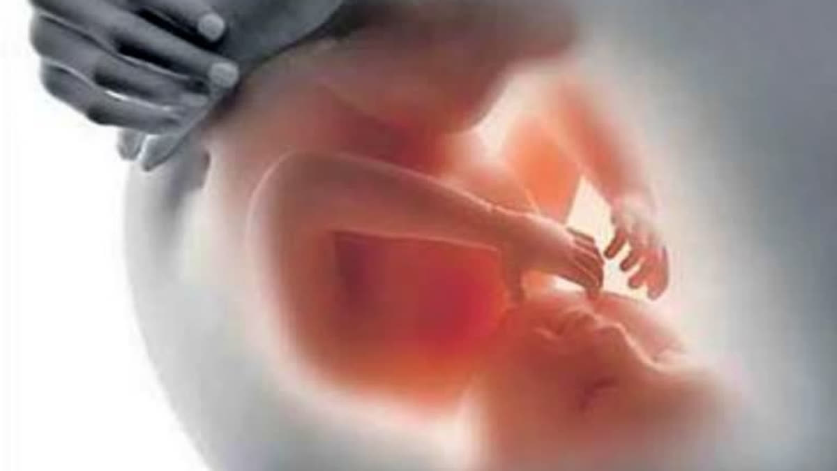 A majority of cases are preventable with good hygiene and food habits (Representational Image)