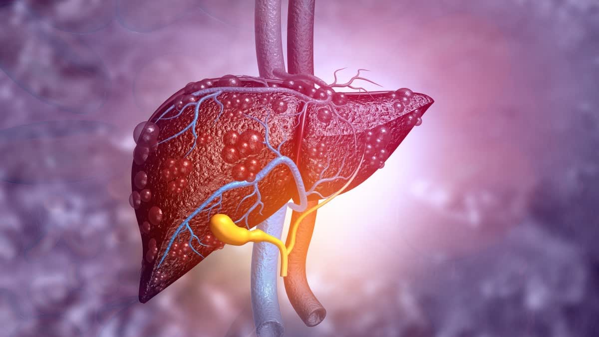 கொழுப்பு படிந்த கல்லீரலை குணப்படுத்த உதவும் 3 பானங்கள்: எய்ம்ஸ் மருத்துவர் பரிந்துரை!