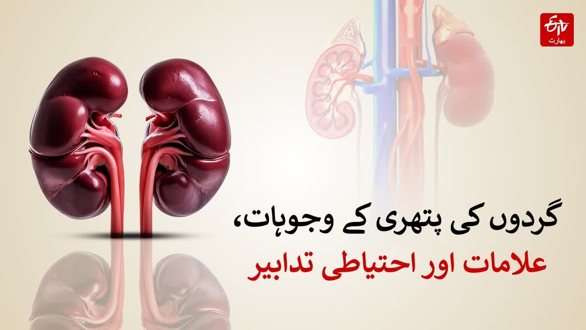 گردوں کی پتھری ایک عام مگر نہایت تکلیف دہ مرض ہے
