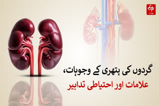 گردوں کی پتھری ایک عام مگر نہایت تکلیف دہ مرض ہے