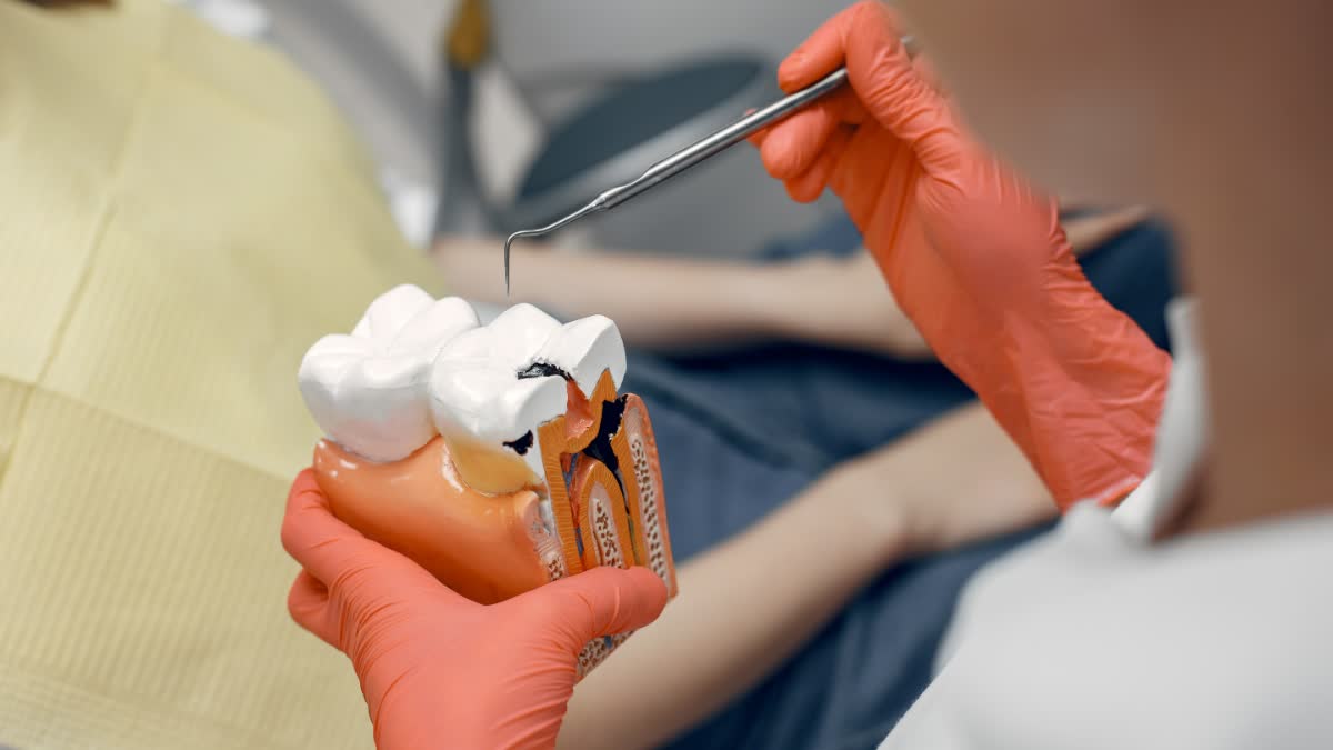 Root Canal Care: How to Protect and Maintain Your Treated Tooth