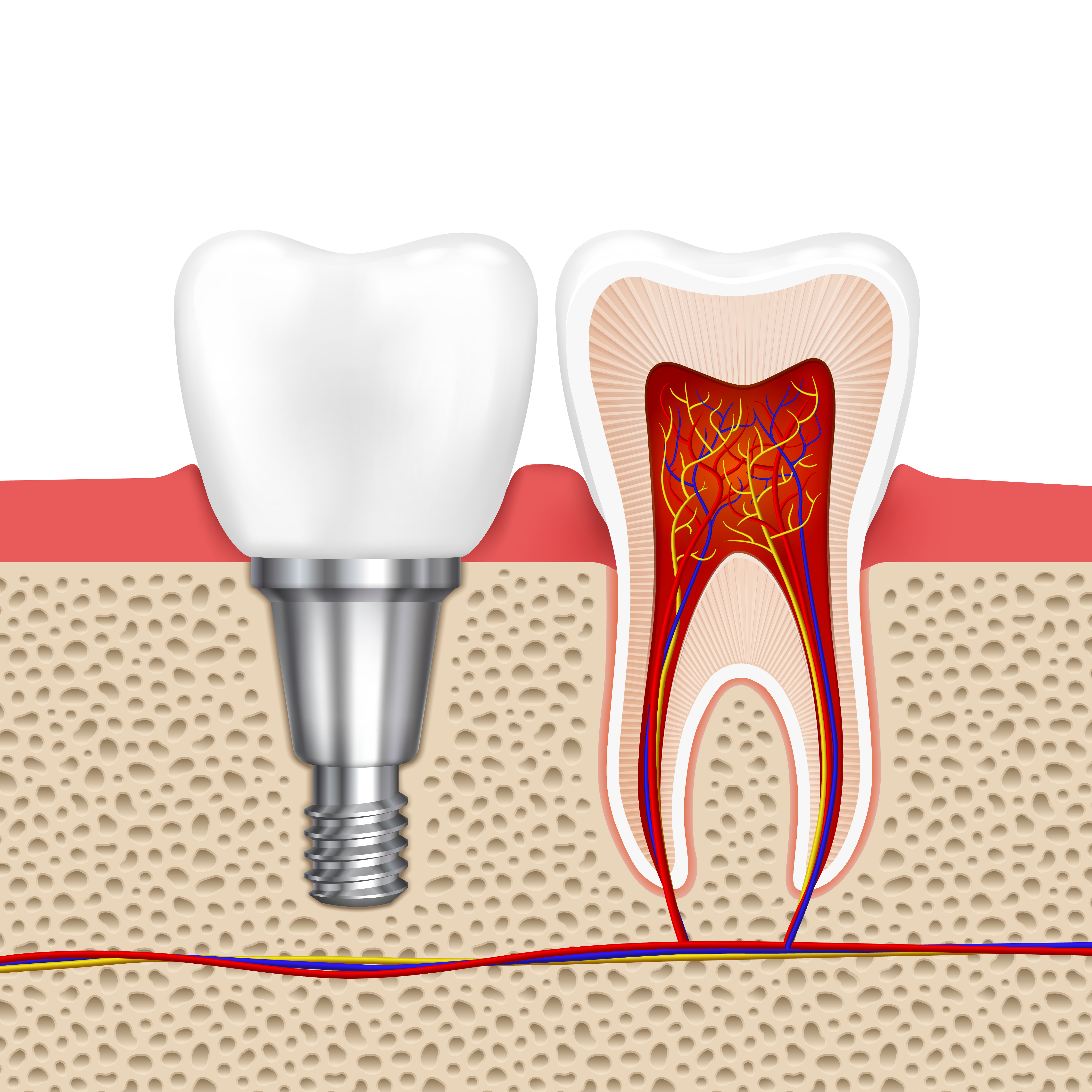 Root Canal Care: How to Protect and Maintain Your Treated Tooth