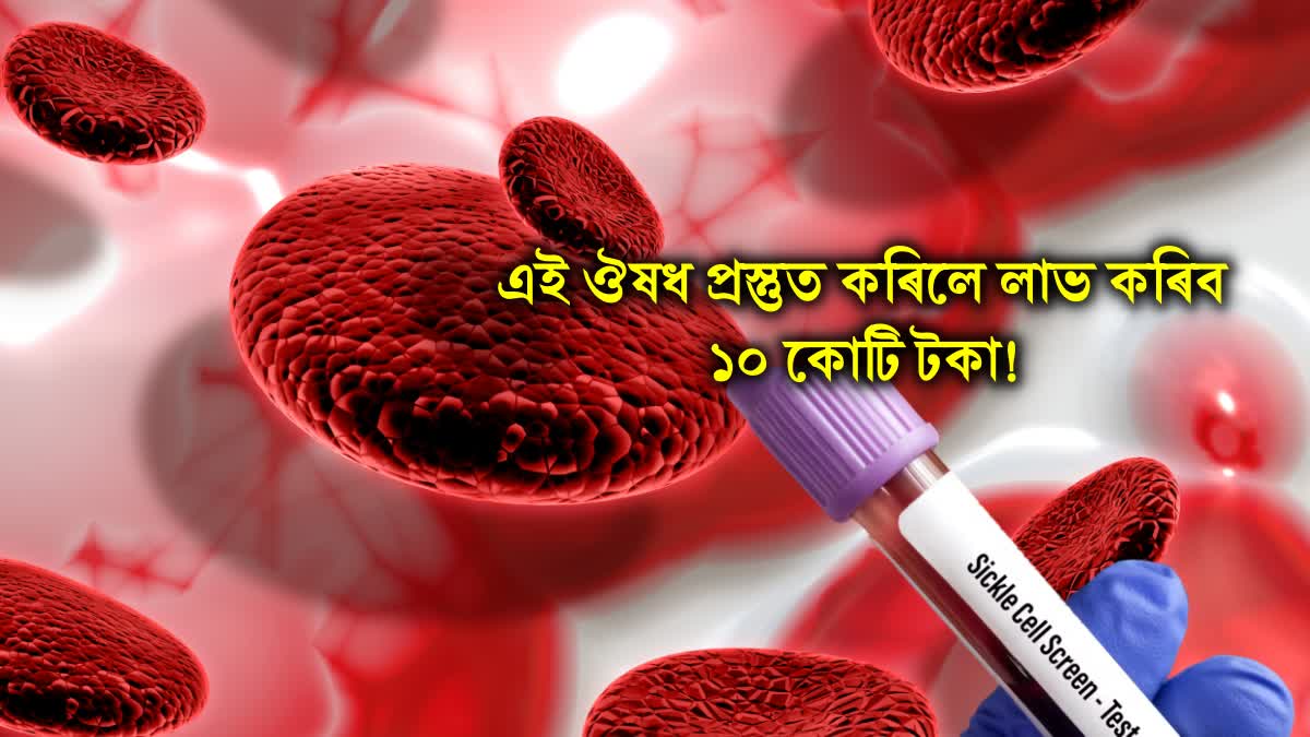 SICKLE CELL DISEASE