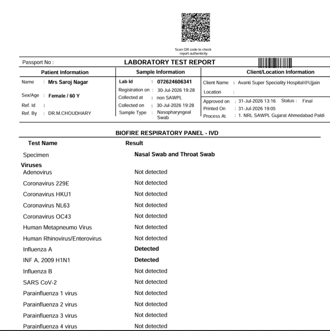 SWINE FLU test report