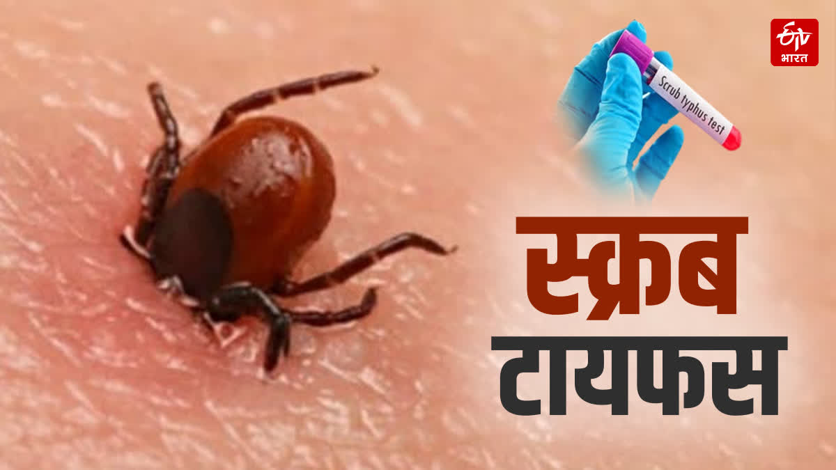 स्क्रब टायफस