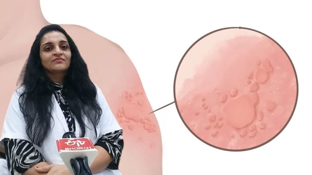 શિયાળામાં ચામડી અને વાળની રાખો ખાસ કાળજી, ગંભીર રોગોથી બચવા કરો આ ઉપાય