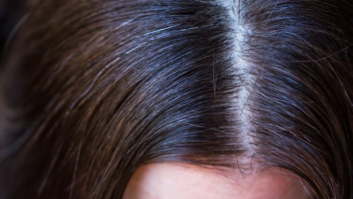 இளநரை கருகருவென மாற வேண்டுமா?