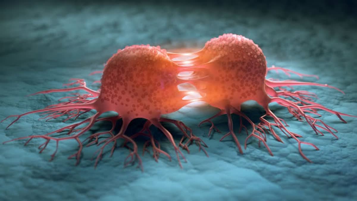 Assam affects cancer More than 45000 people are affected annually