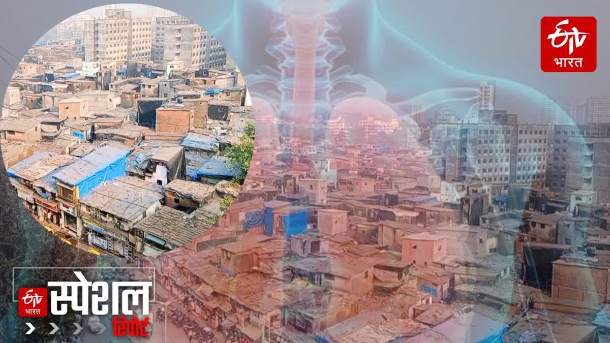 DHARAVI TUBERCULOSIS PATIENTS