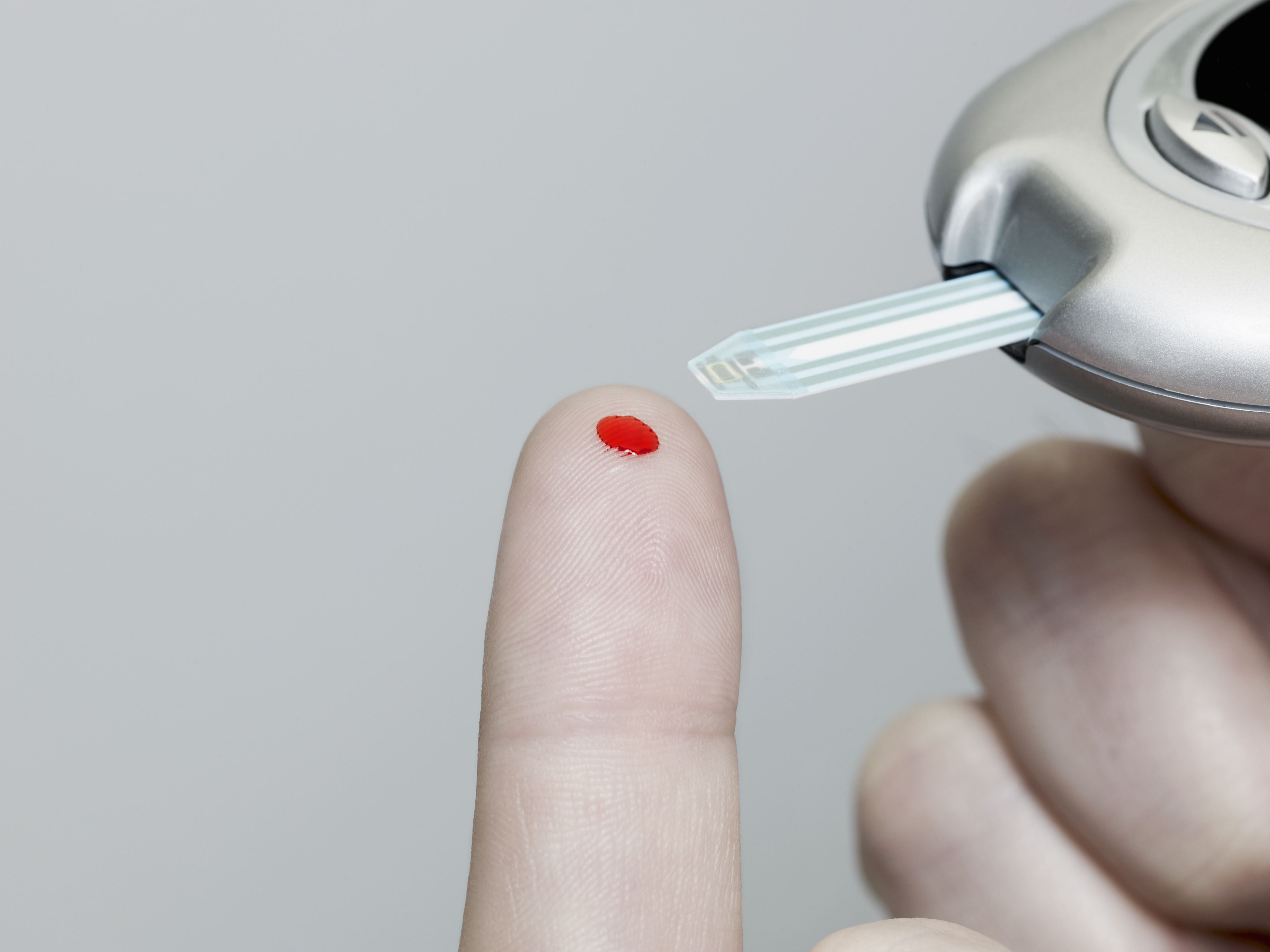 Diagnosis of Type 5 Diabetes involves both clinical evaluation and blood tests (Representational Image)