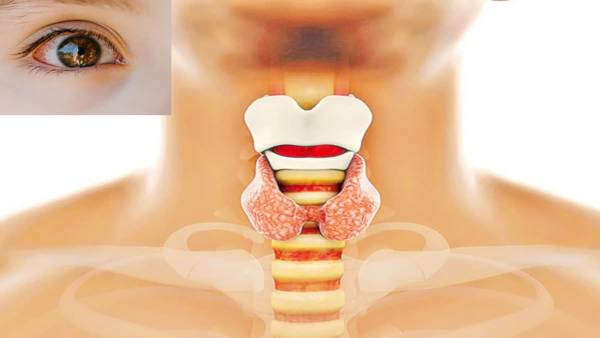 Find out how thyroid disease affects the eyes. What are its symptoms and causes?