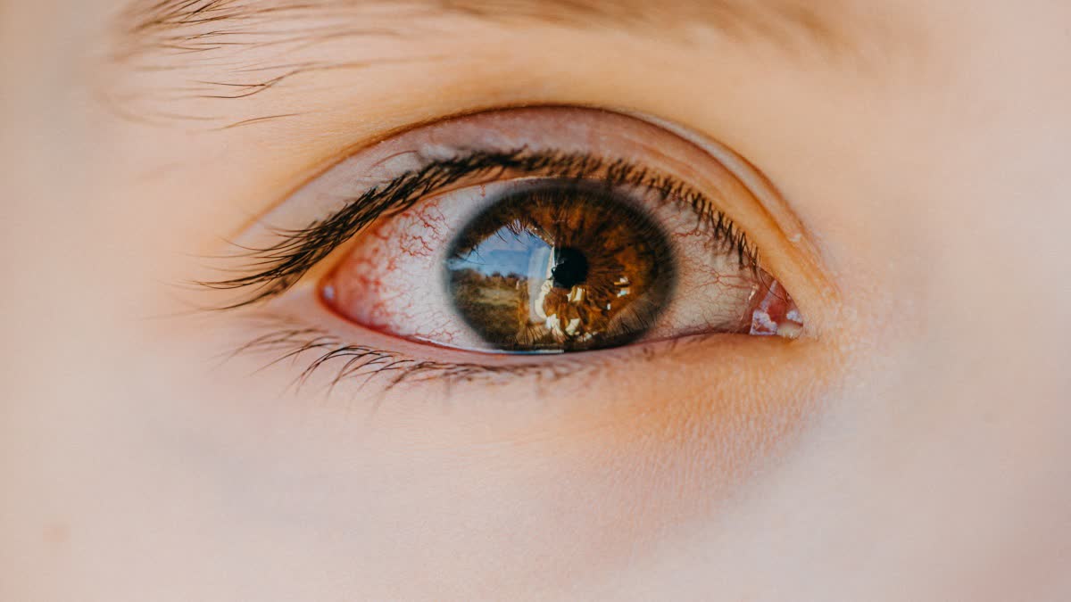 Find out how thyroid disease affects the eyes. What are its symptoms and causes?