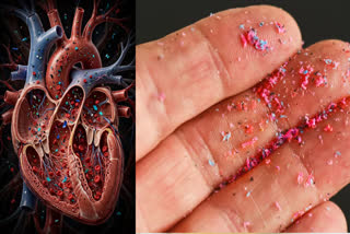 MICROPLASTICS AND HEART DISEASE