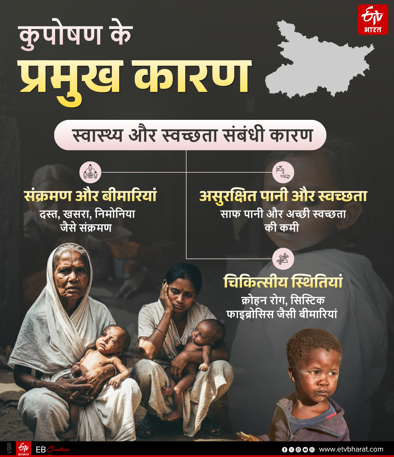 BIHAR MALNOURISHED CHILDREN