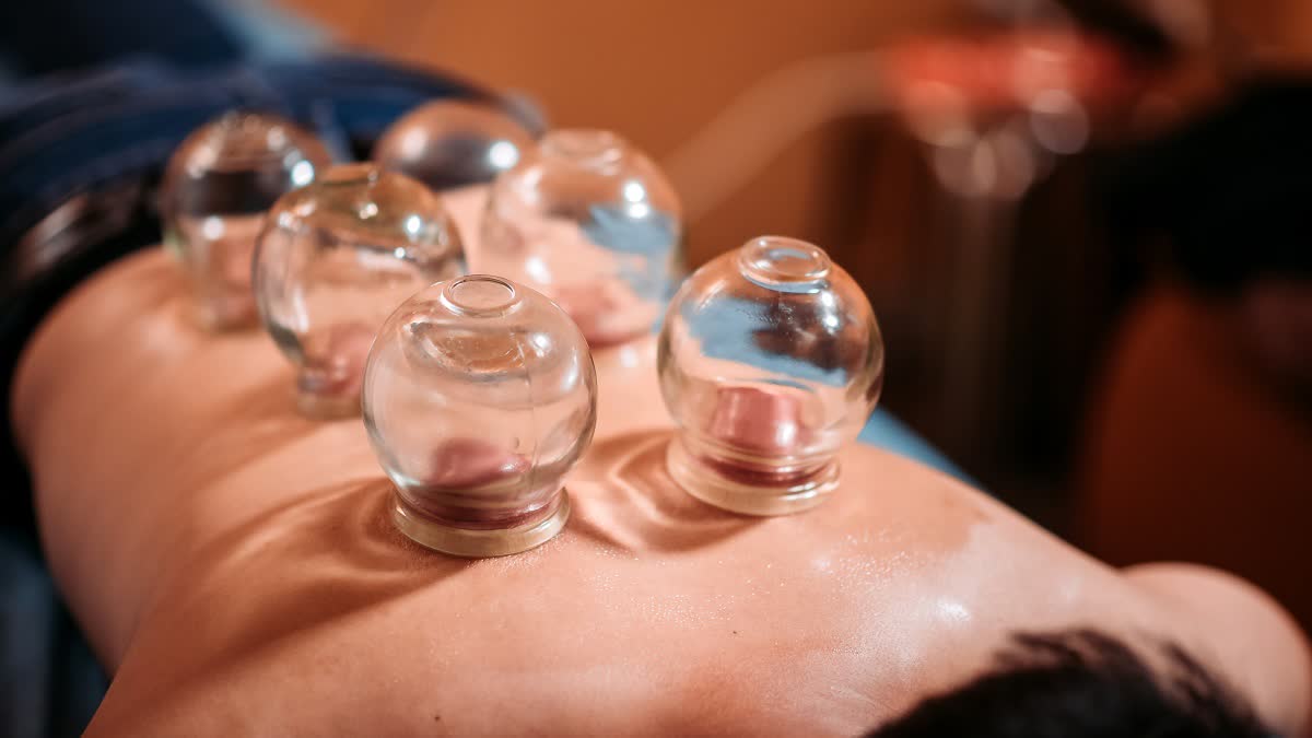 CUPPING THERAPY  IS CUPPING THERAPY GIVES RELIEF  BENEFITS OF CUPPING THERAPY