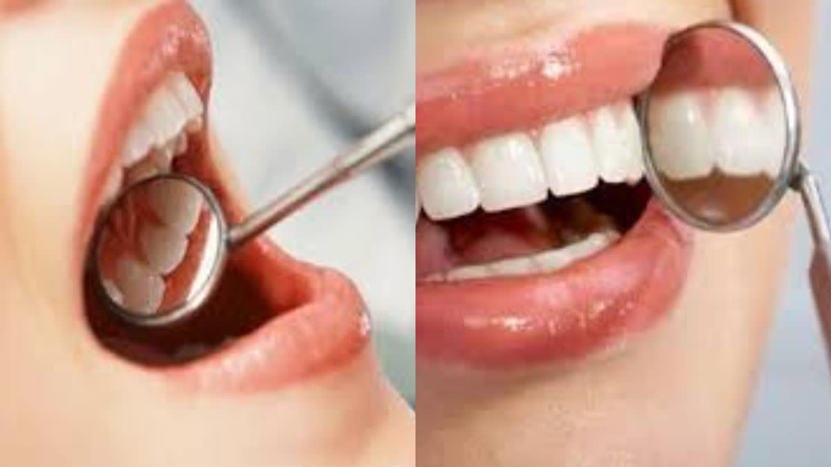 BLEEDING GUMS