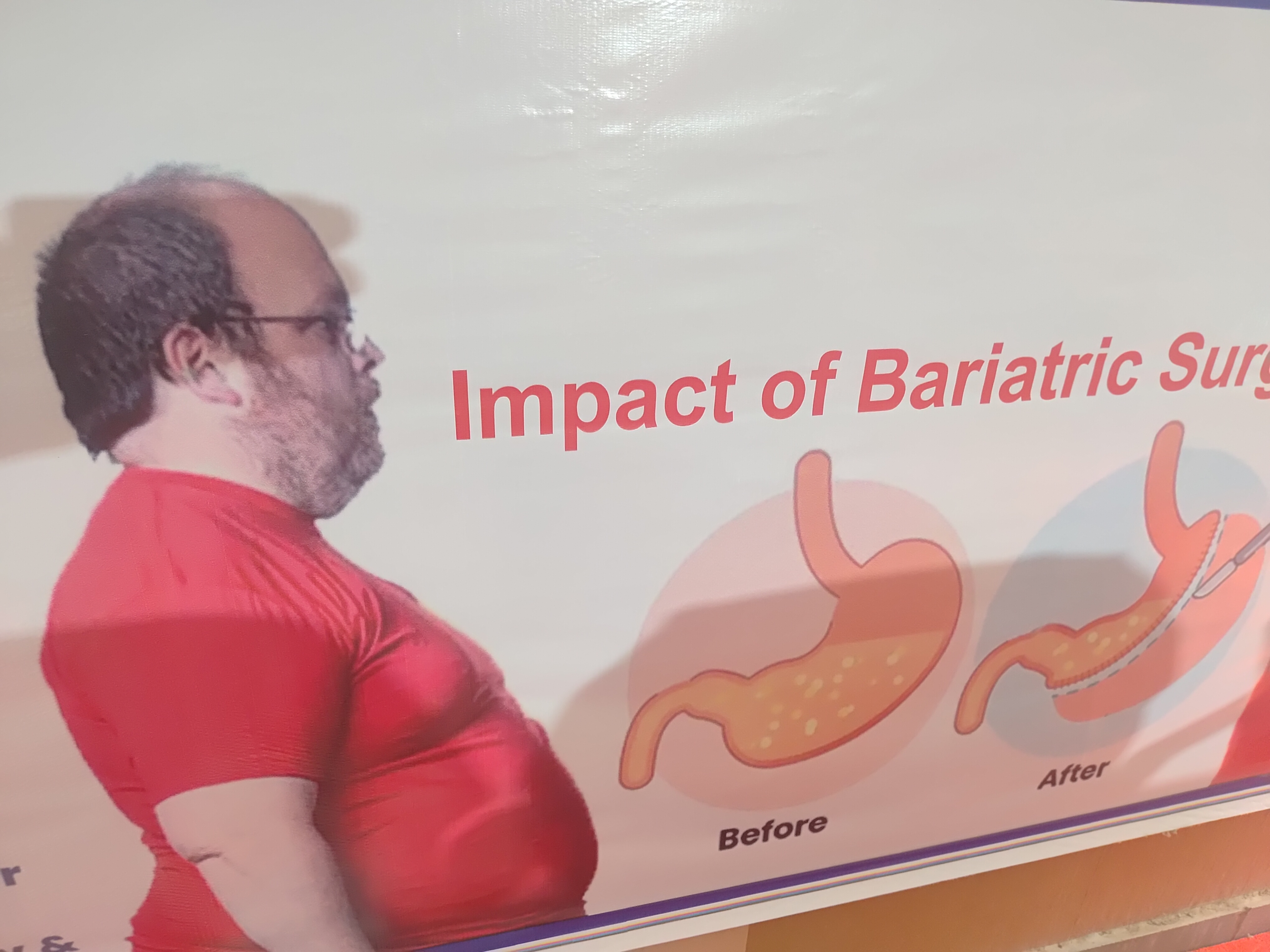 MAHARAJA YASHWANTRAO HOSPITAL