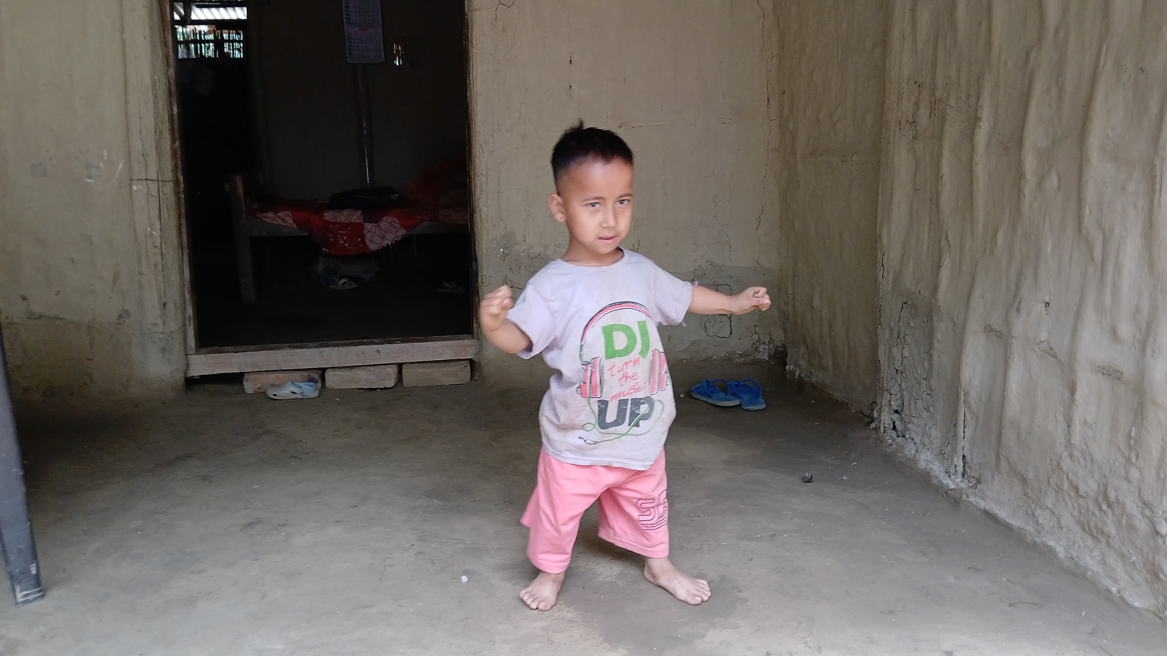 Families with congenital disabilities have not received the benefits of government schemesFamilies with congenital disabilities have not received the benefits of government schemes