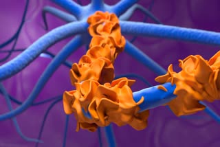 RATLAM GBS POSITIVE PATIENT