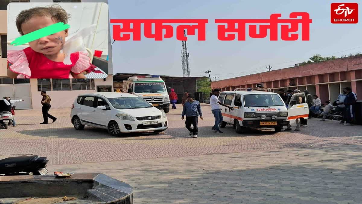 आवारा कुत्तों ने नोंच डाला था बच्ची का चेहरा.