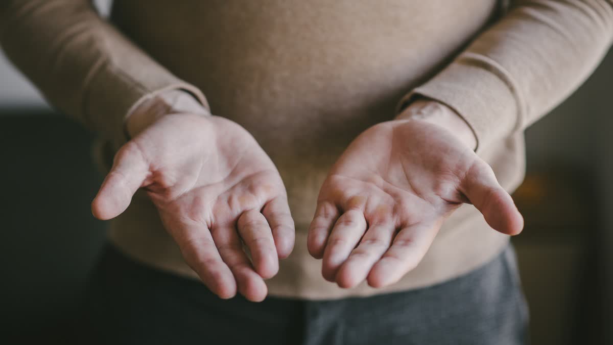 HANDS SWEATING CAUSES