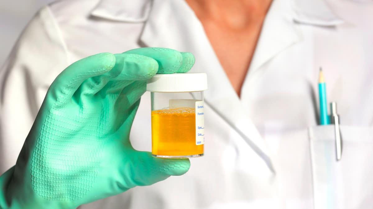 Blood in the urine