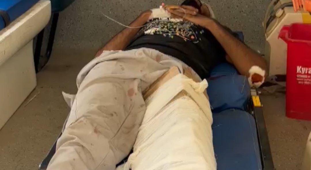 टूटी हड्डी पर कार्टन लपेटकर इलाज