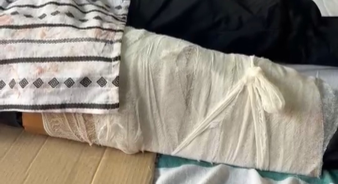 टूटी हड्डी पर कार्टन लपेटकर इलाज
